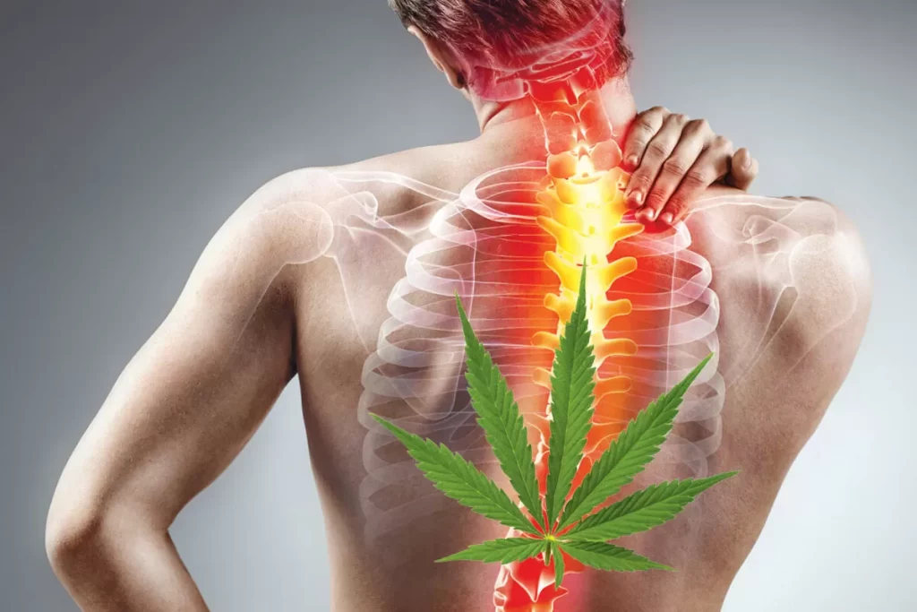 Medical Cannabis as a Back Pain Treatment | Neuroprotection
